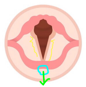 vocalcords